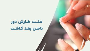 علت خارش دور ناخن بعد از کاشت